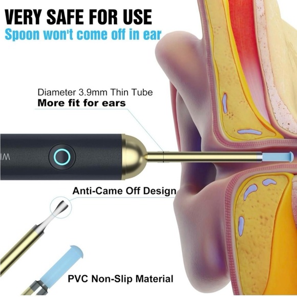 Wireless Ear Wax Removal Tool - Picture 5 of 8